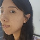 앰앤더블유뷰티(M&W) | 충주왁싱샵 다니에뷰티 충주브라질리언왁싱 슈가링 왁싱 구렛나루왁싱 인중왁싱 하드왁싱 후기