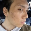 하늘체한의원 | 하늘체한의원 인천 새살침 후기(2회차)｜1회차 대비 체감 차이와 회복 과정