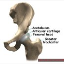 고관절인공관절수술 잘하는곳 // 수술부터 재활까지 이미지