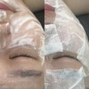 이마트24보정죽현점 | [김천 혁신도시 진앤뷰티] 피부 관리/리프팅/방문 후기/솔직 후기