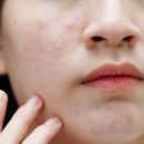 인우한의원 이미지