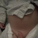 7개월 아기 탈장수술 후기😭😭[부산주외과👍🏻]