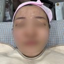 뷰티스에스테틱 | 광주 상무지구 ‘뷰티스에스테틱’ : 예신 이중턱 LDM 탄력관리 받고 왔어요