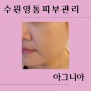 수원영통피부관리 아그니아에서 작은얼굴윤곽 후기