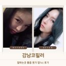 (주)케이스코 | 강남코필러 잘하는곳 통증 붓기 멍1cc 후기