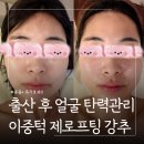 디유아이인테리어 | 출산 후 피부관리 디유에스테틱 왕십리점 이중턱 제로프팅 후기