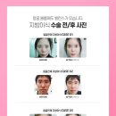 오네뜨의원 이미지