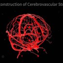 업브레인 이미지