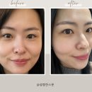 검단피부관리 홍에스테틱에서 수분 충전 피부 케어받은 후기