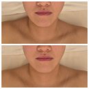 순환 | 용인피부관리 메디스파연 시그니처 순환 관리 후기