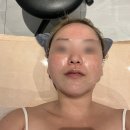 연산동 SK VIEW(2단지) | 부산 써마지 잘하는곳 신부관리 에스테틱 교대 윤곽관리 피부샵 도예스킨 후기