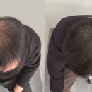 스칼프디자인센터 이미지