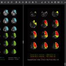 제이엘케이 이미지