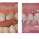 열린치과 이미지