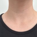 청담공의원 | 청담공의원 디어넥주사 강남목주름 1회차후기