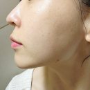 이뉴 | 붓기완화템 화잘먹템 마스크팩추천 이뉴바 플렉시 스트레치 마스크 사용 후기