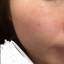 롤링핀 동탄점 | 동탄 에스테틱 : 블링s스킨케어(주차,블링s맞춤케어) 피부관리 추천 후기