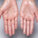 땀이줄줄 이미지