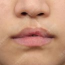 그림성형외과의원 네이버블로그