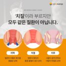 인천항외과의원 | 인천항외과 치질초기증상 방치하면 3배 더 악화 <지금이 골든타임 입니다>