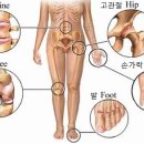 통증-퇴행성관절염(골관절염)/오십견 근원적 자연치료 이미지