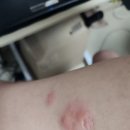 김호철내과의원 네이버블로그