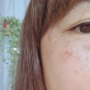 벼르고 벼르던 피부관리 :: 아가파의원 서창점