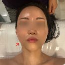 삼성1차(아) | 삼성역 피부관리 | 더윤 에스테틱 윤곽+근막관리 받고 온 1차 후기