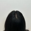 스칼프디자인센터 홍대점 이미지