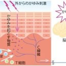 「가려움」의 악순환을 끊으려면 보습과 자외선으로 대책 이미지