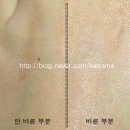 [쑨다리/Sundari] 에센셜 오일 포 피타 스킨 (중복합성 피부용 에센셜 오일) 이미지