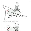 비스타짐 이미지