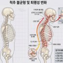마산마취통증의학과 목디스크와 거북목 통증을 위한 비수술 치료