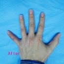 강남챔피언정형외과의원 이미지