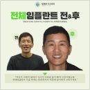 센텀치과기공소 | 해운대치과 임플란트 식립 두려워말고