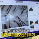 웰킨광명 | 철산 두피관리 웰킨두피탈모센터 광명철산점 파워디톡스스케일링 후기