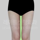 레아트성형외과의원 이미지