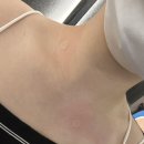 대치뷰티라운지의원 | 부천 인중 겨드랑이 레이저 제모 점 제거 "뷰티라운지의원" 내돈내산 솔직후기