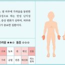 염증성 피부질환의 진단, 감별-한포진, 물집습진(1) (사진혐주의) 이미지