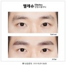 서면엘레슈의원 이미지