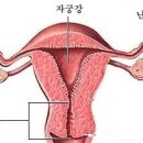 자궁 그림 보는법 (이 글을 먼저 읽어 주세요) 이미지