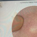 바르다성형외과의원 네이버블로그