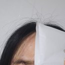 최고한의원 | 창원리프팅 눈매교정 효과 최고 창원한의원(후기/통증정도/효과)