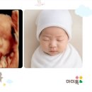 서울미즈병원 이미지