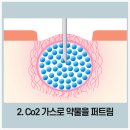 닥터(Dr.)초이 피부과의원 | 압구정로데오피부과 여드름흉터 모공 볼륨개선 쥬베룩...치료후기! (feat 미라젯 ) by dr.kang 선릉역...