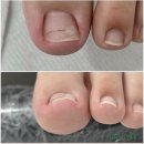 쥬비네일 이미지
