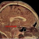 시상하부(視床下部, hypothalamus) 이미지