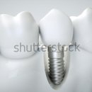 상치과의원 이미지