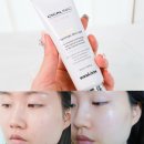 트러블과 흉터로 고민인 피부 주목! 마스크로 인한 피부 자극 일주일 동안 피부 변화 | 시카리닉 PSL 크림