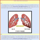 호흡기질환 - 기관지 확장증 (Bronchiectasis) 이미지